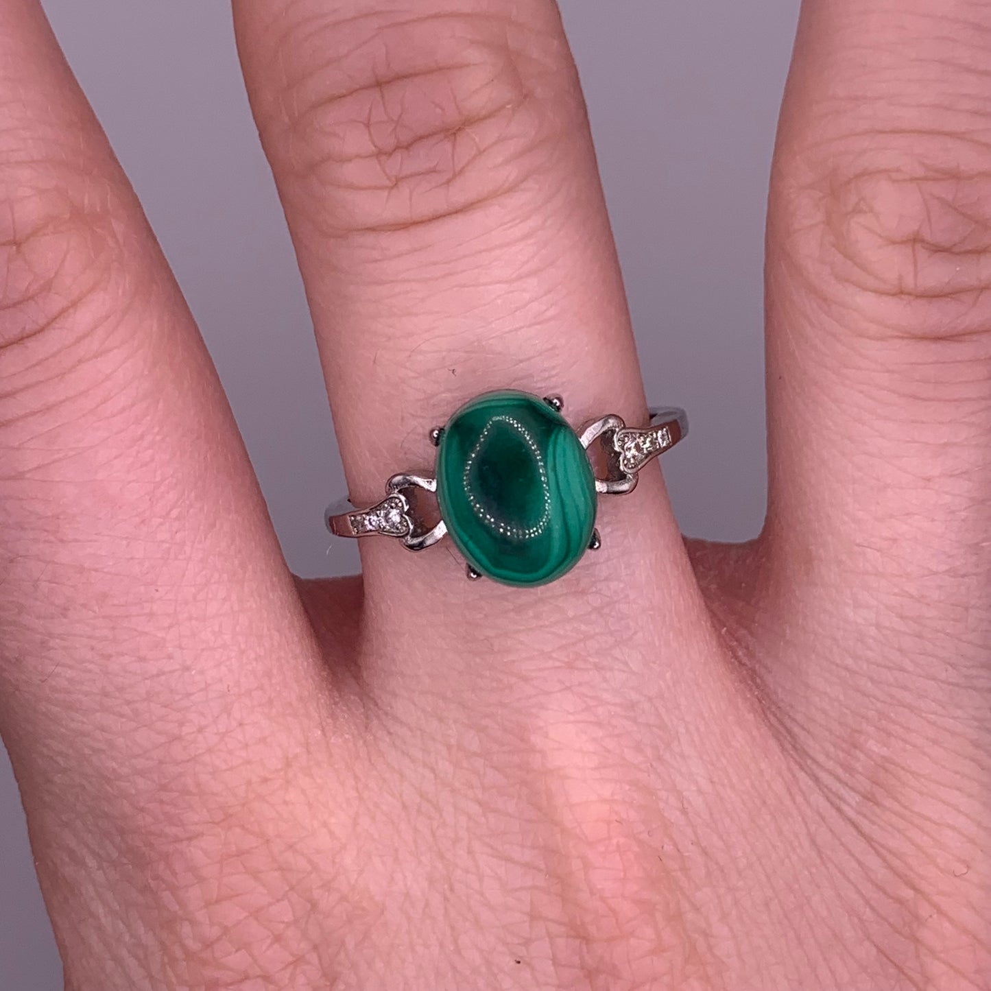 Malachite Ring